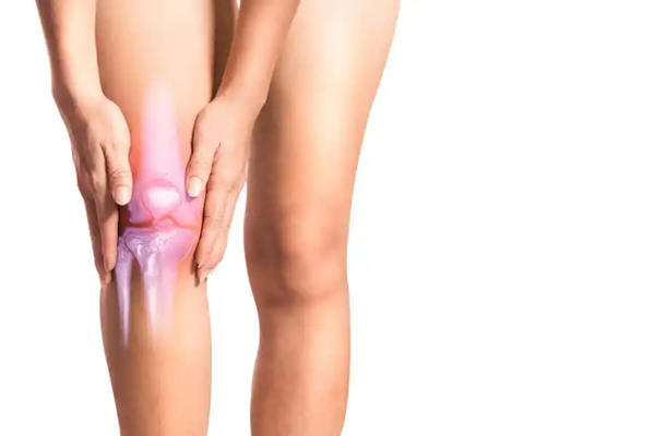 Knie bei Arthrose: grafische Darstellung des Kniegelenks
